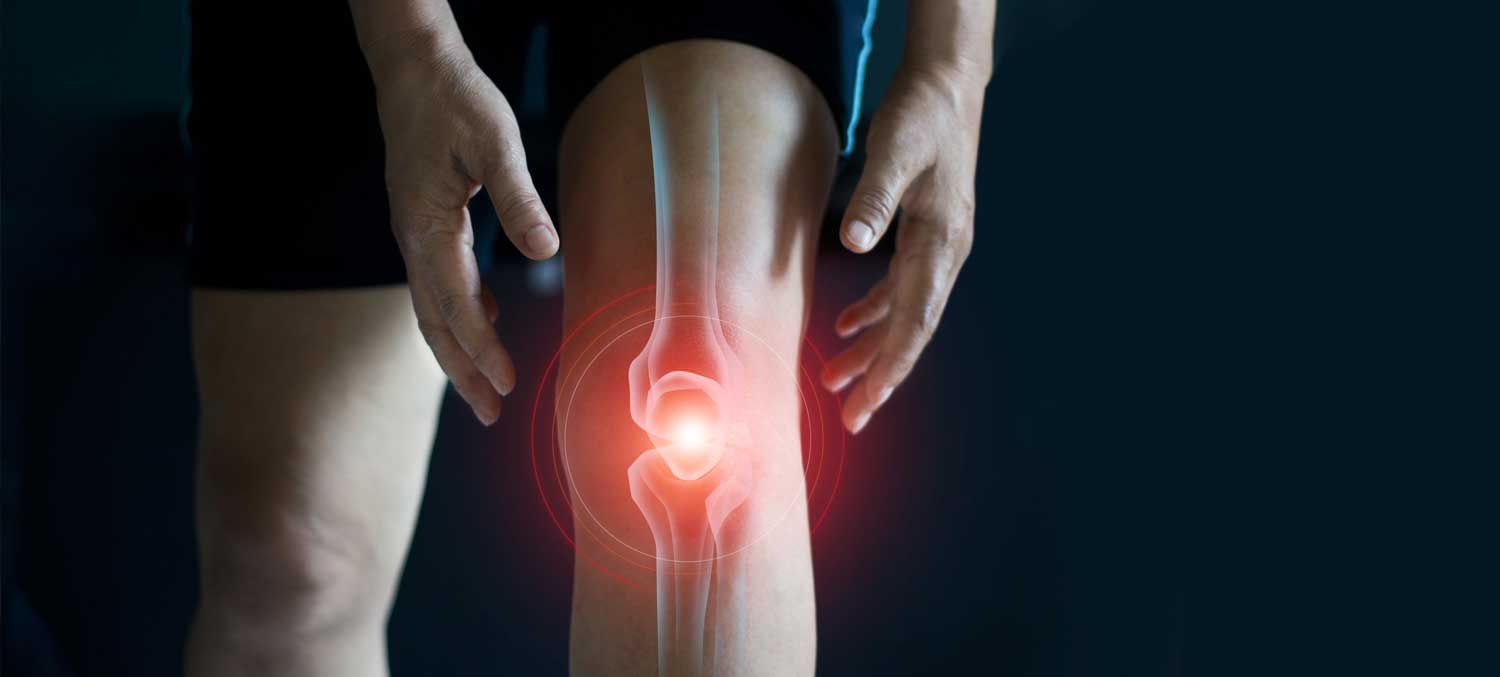 Knee Pain 3D Visual